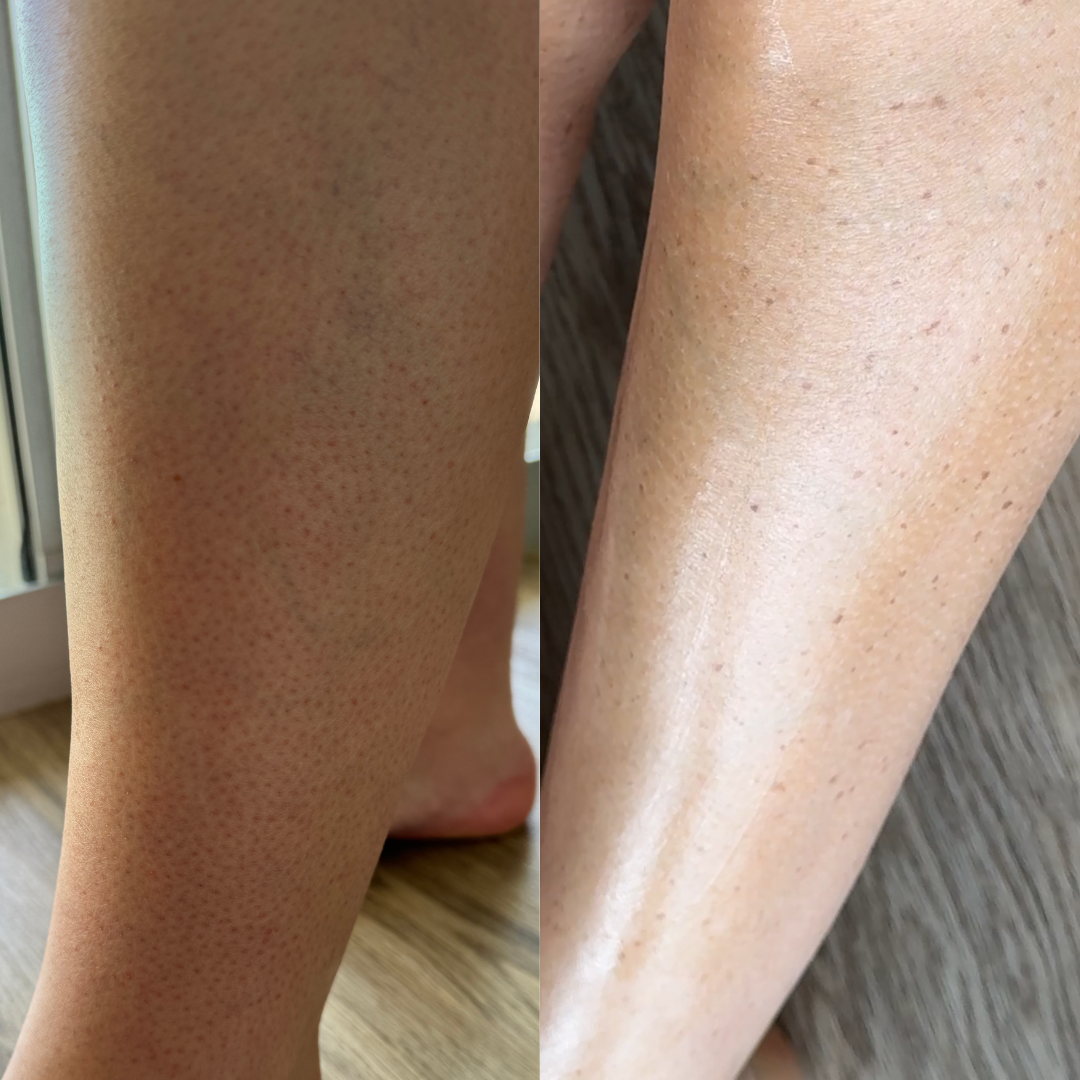 Kiss KP Goodbye 2 Step Routine