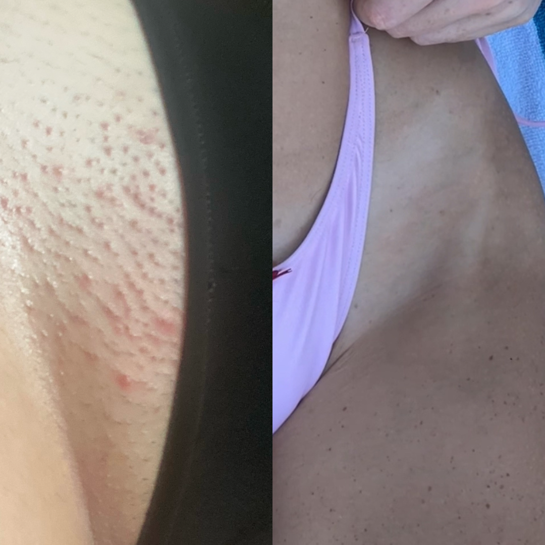 Smooth Shaving Bundle