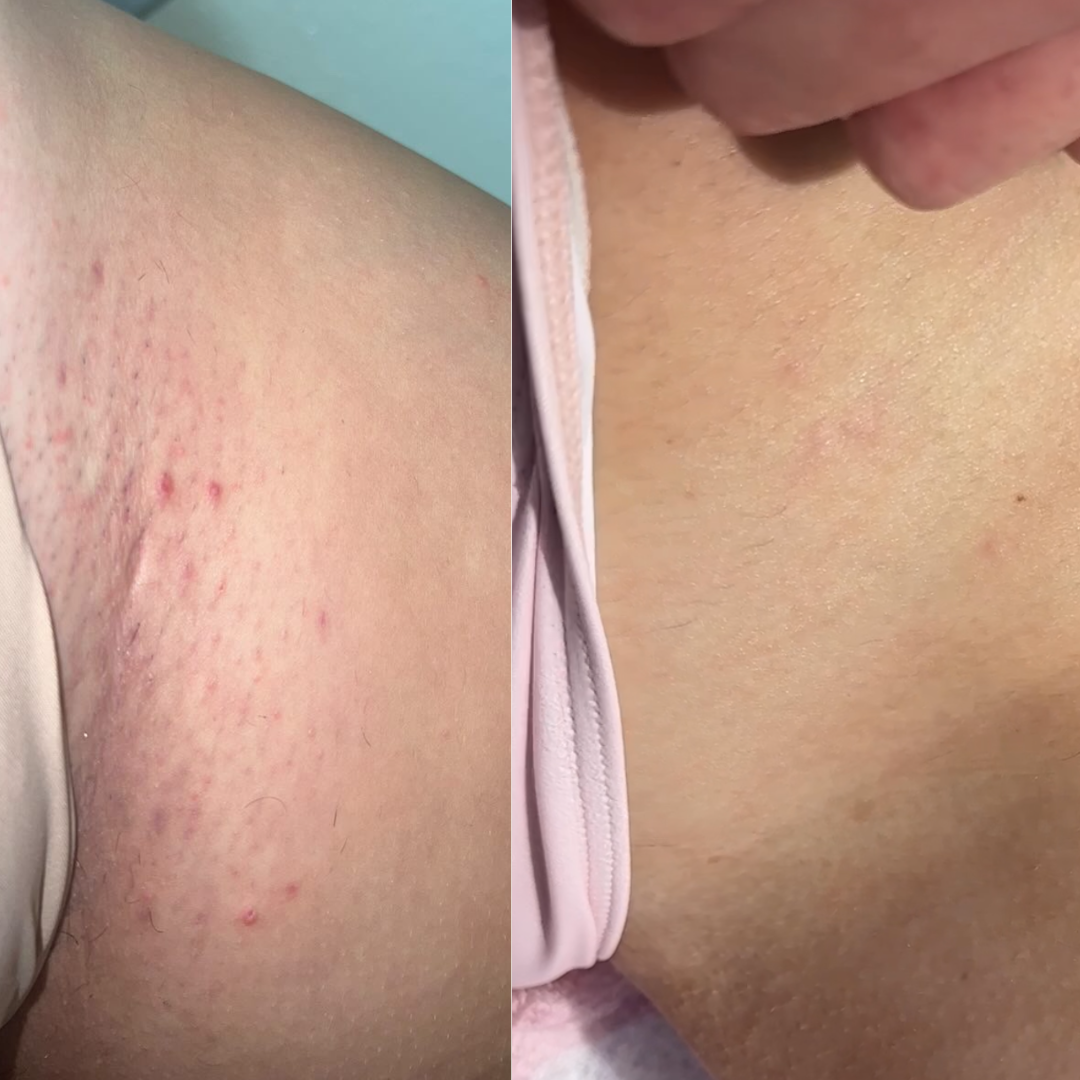 Smooth Shaving Bundle