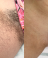 Smooth Shaving Bundle